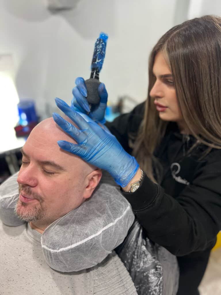 SMP artist Ell performing scalp micropigmentation at SMP-Clinic in Stockport, known for her soft, natural hairline technique and healed results.